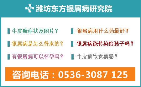 濰坊的醫(yī)院哪家治療銀屑病專業(yè)